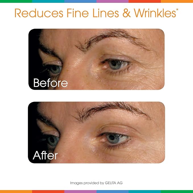 Sparkle Wellness Skin Boost Plus Verisol Collagen Peptides Protein Powder Vitamin C Orange Plus Supplement Drink, 7.7 oz