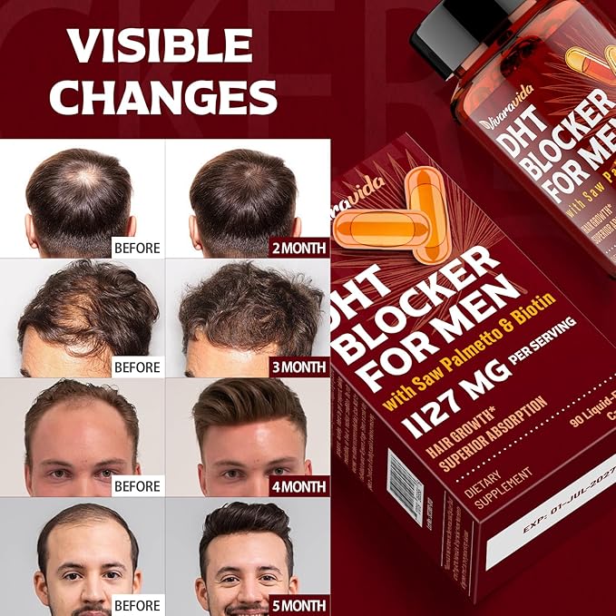 DHT Blocker for Men | Hair Growth Supplement with Saw Palmetto & Biotin - Hair Growth Vitamins - Hair Regrowth - Natural Hair Loss Supplements Liquid-Filled - Proprietary Herbal Blends (180 Capsules)