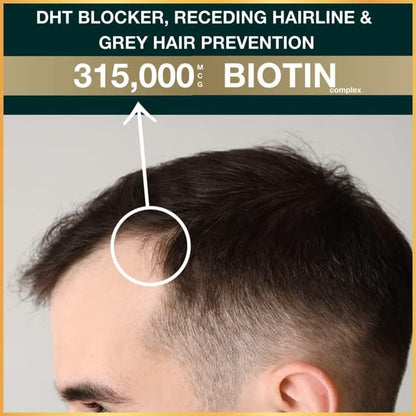 Hair Vitamins for Men Beard Growth MSM Powder Saw Palmetto Hairtonica | Extra Strength 315,000 mcg Biotin Keratin Collagen | May Help Support Hair Loss Greying & Thinning | 60 ct