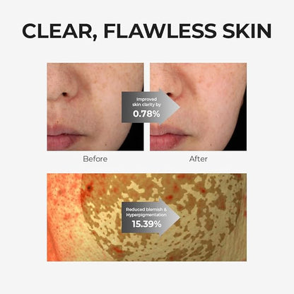 [Skin&LAB] Glutathione Ampoule Toner 6.76 fl oz, Improve Dart Spot, Hyperpigmented, Skin Clarity, Korean Toner for Sensitive Skin