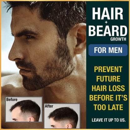 Hair Vitamins for Men Beard Growth MSM Powder Saw Palmetto Hairtonica | Extra Strength 315,000 mcg Biotin Keratin Collagen | May Help Support Hair Loss Greying & Thinning | 60 ct