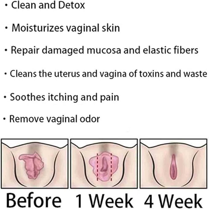 Instant Anti-Itch Detox Products, Capsulas, Firming Repair & Pink and Tender Natural Capsules, Capsulas (3Bag)