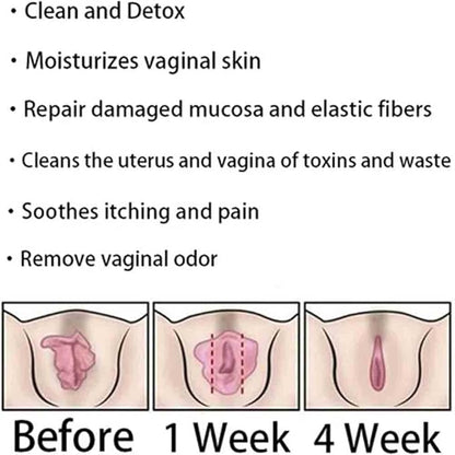 Instant Anti-Itch Detox Products, Capsulas, Firming Repair & Pink and Tender Natural Capsules, Capsulas (5Bag)