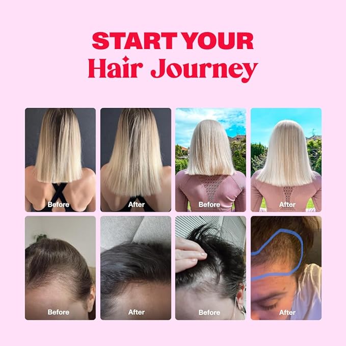 Hair Gummy Prenatal Vitamins for Women Pregnancy with Vitamin B6 - Pre Natal Multivitamin for Women & Folic Acid - 60 Prenatal Gummies - Hair Gummies for Women with Folic Acid (1Pack)