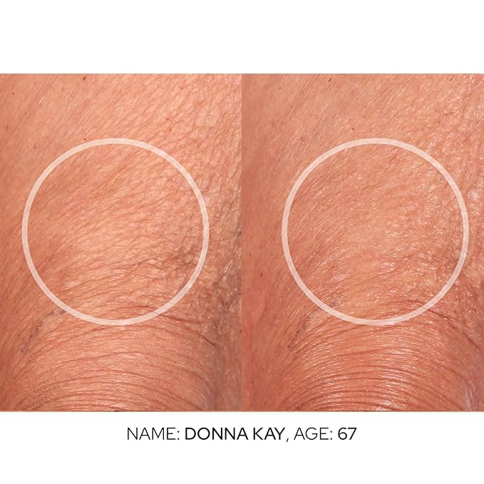 SiO Cryo Multivitamin Face & Body Scrub - Antioxidant-Rich Exfoliator