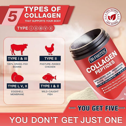 Multi-Collagen-Peptide-Powder with Probiotics, 50 Servings of Hydrolyzed Collagen Peptides with Hyaluronic Acid, Biotin & Multivitamins - Supports Skin, Hair, Nails Health