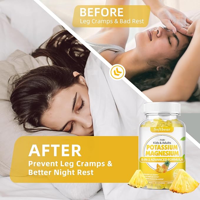 softbear Potassium Gummies for Adults, Sugar-Free Potassium Magnesium Supplement with Vitamin B6 CoQ10 for Muscle Cramps Vegan Pineapple Flavor 120 Gummies