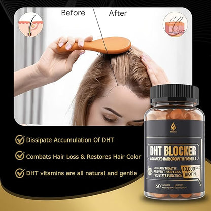 DHT Blocker Gummies Hair Growth Supplement, Super Potency Saw Palmetto & Biotin 10000 mcg for Women & Men, Plus 12 Proprietary Blend - Prevent Hair Loss, Blocking DHT Receptors, 2Pc/120ct