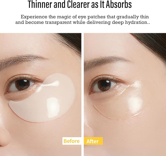 MediAnswer Vita Collagen Eye Cream Patch, K-Beauty Advanced Under Eye Treatment with French 500Da Collagen & Multi-Vitamin Complex (60 Patches)