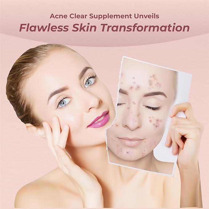 PUREHEALTH RESEARCH Hormonal Acne Supplements - Say Goodbye to Breakouts with Acne Supplements for Women - Zinc for Acne - Powerful Acne Vitamins with Vitamin B5, and Barberry Fruit Extract -1 Bottle