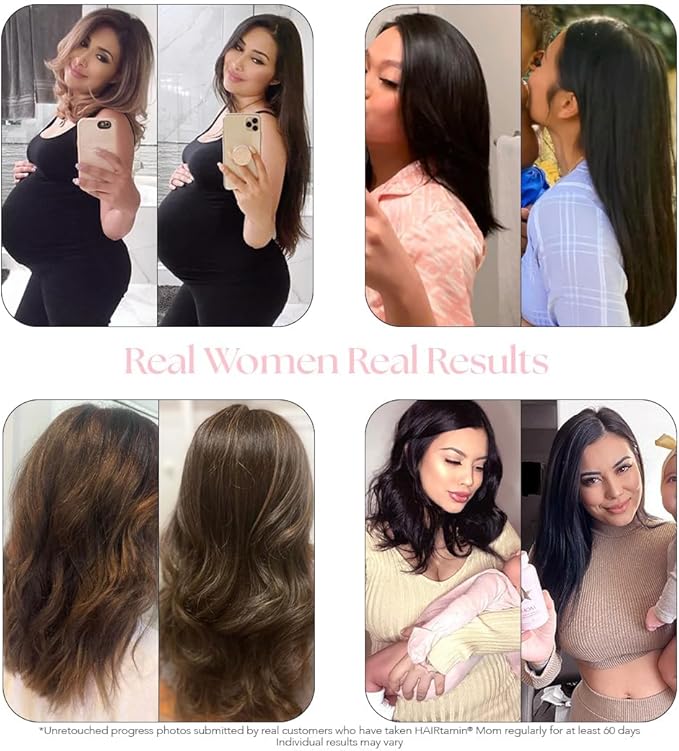 HAIRtamin MOM Vegan Prenatal & Postnatal Multivitamin Supplement & Hair Vitamin Pregnancy, Postpartum, Breastfeeding Probiotic One-a-Day Hair Vitamins with Biotin, Zinc, Iron (30 Counts)