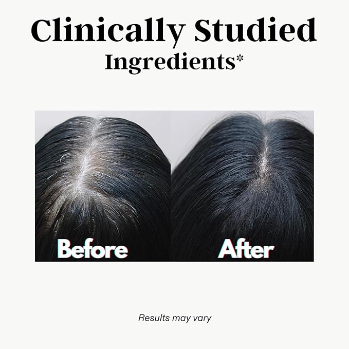 Gray Hair Rescind with Catalase - Antiaging Hair, Skin and Nails Vitamins, Pantothenic Acid, Folic Acid 400mcg, Biotin 300mcg, Saw Palmetto for Men and Women