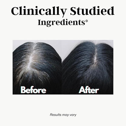 Gray Hair Rescind with Catalase - Antiaging Hair, Skin and Nails Vitamins, Pantothenic Acid, Folic Acid 400mcg, Biotin 300mcg, Saw Palmetto for Men and Women