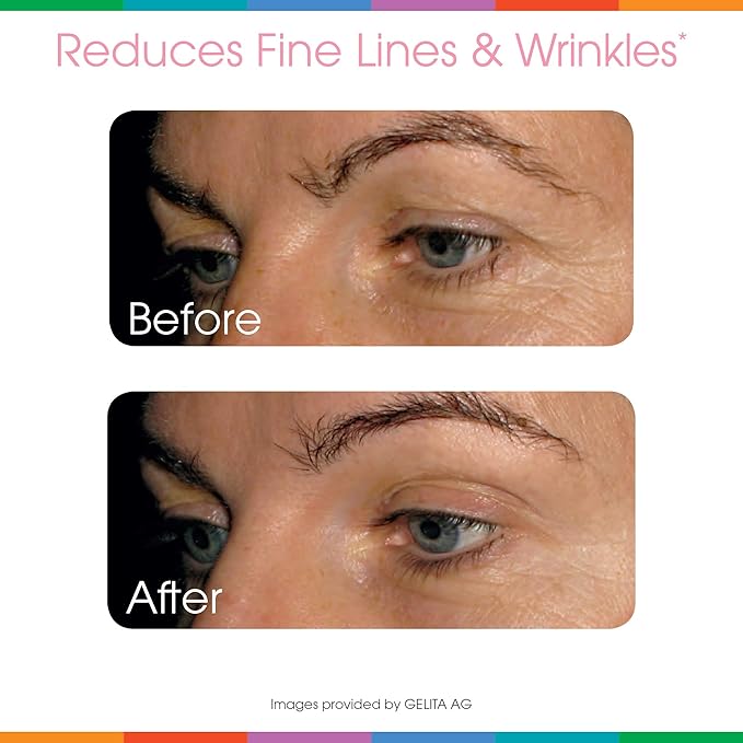 Sparkle Wellness Skin Boost (Acai Lemonade) [30-Serves] | Collagen Powder Supplement with VERISOL Bioactive Hydrolyzed Collagen Peptides & Vitamin C to Improve Skin, Hair & Nail Health