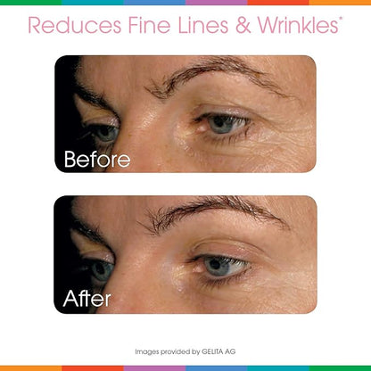 Sparkle Wellness Skin Boost (Acai Lemonade) [30-Serves] | Collagen Powder Supplement with VERISOL Bioactive Hydrolyzed Collagen Peptides & Vitamin C to Improve Skin, Hair & Nail Health