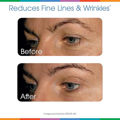 Sparkle Wellness Skin Boost Plus (Tropical) [30-Serves] | Collagen Powder Supplement with VERISOL Bioactive Hydrolyzed Collagen Peptides, Vitamin C & Hyaluronic Acid