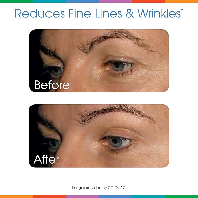 Sparkle Wellness Skin Boost Plus (Tropical) [50-Serves] | Collagen Powder Supplement with VERISOL Bioactive Hydrolyzed Collagen Peptides, Vitamin C & Hyaluroic Acid