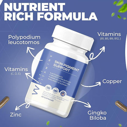 Skin Pigment Support | Polypodium Leucotomos Supplement | Antioxidant & Immune Support | Works Faster Than Vitiligo Cream | Skin Health & Pigmentation Support for Women & Men | 60 Caps