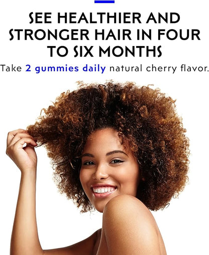 Elon Biotin Gummies for Hair Growth – 60 Count Biotin 5000mcg Vitamins for Hair, Skin and Nails – Biotin Hair Vitamins – Hair Growth Pills – Hair Growth Supplements – Vitamins Hair (Pack of 1)