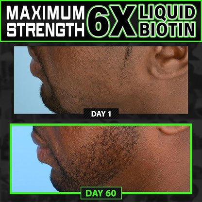 MAXIMUM STRENGTH Biotin 96,000mcg Collagen Peptides LIQUID Collagen for Men Hair Growth & Beard Growth Supplement with 6X More Absorption vs Competitor Vitamins, Serum, or Pills (2 OZ) made by BBS USA