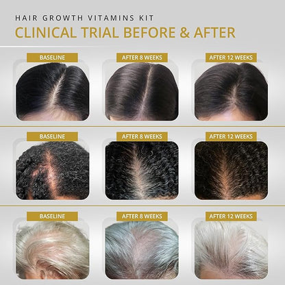 VITAMINS REVIVE Hair Supplement Hair Growth Vitamins for Women - USA Clinically Tested - Hair Loss Products for Thinning & Thickening - Female Hair Regrowth Treatment (2 Month Supply)