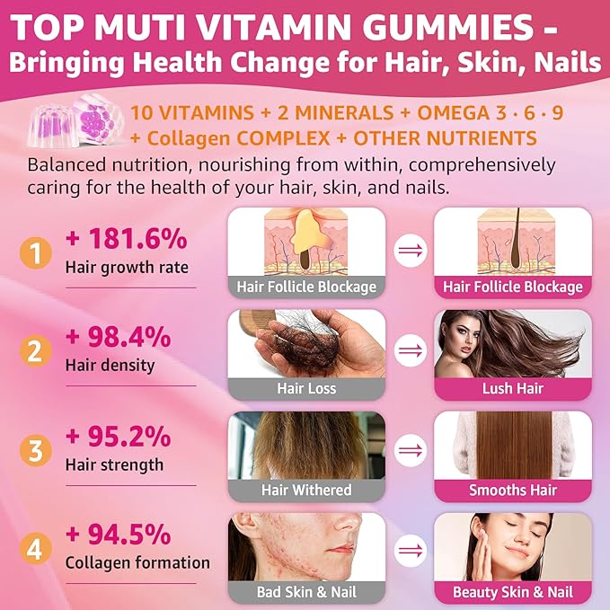 Hair Vitamins Gummies + Collagen Peptides, Biotin, Omega-3 6 9 for Women Men/w Vitamin A, C, B, Iron, Zinc - Multivitamin Gummies for Follicles, Hair Growth & Strength, Skin, Nails Health - 60Cts