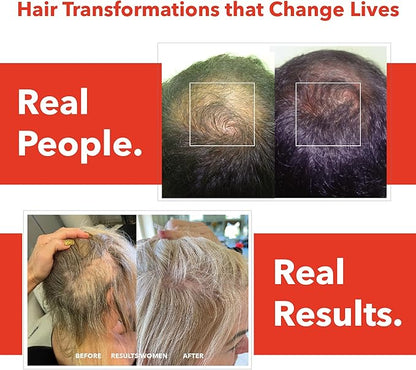 H5 Grow+ Hair Vitamin Supplement – Biotin, Ayurvedic Herbs & 5 Nutrient Groups for Hair Growth, Density & Strength | Best Hair Growth Supplement for Men and Women (Pack of 1) (1 Pack)