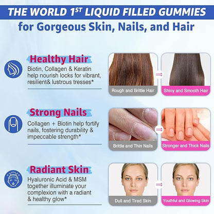 Sugar Free Biotin 1000mcg Collagen Filled Gummies, Multivitamin for Women Hair Skin and Nails Vitamins for Hair Growth, with Hydrolyzed Collagen Peptide hyaluronic Acid MSM Vitamin A C D3 E B Complex