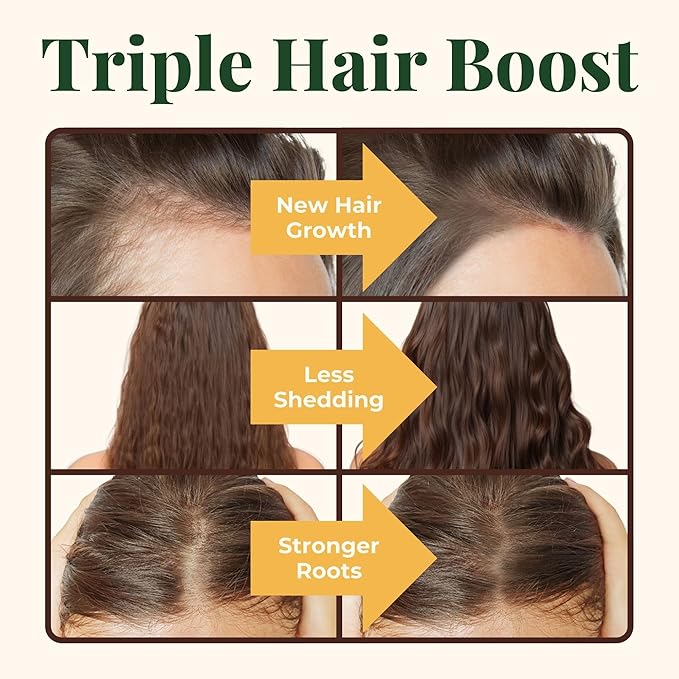 Heebin's Hair Growth Supplements with Biotin 4000 mcg, DHT Blocker and Collagen, for Hair Loss, Thinning and Regrowth, 60 Tablets, 2 Month Supply