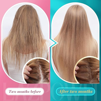 Biotin Gummies -Hair Skin and Nails Vitamins for Men & Women, Vegan Vitamin B7, Supports Hair Growth and Stronger Nails,60 Day Supply-Raspberry-2 Pack