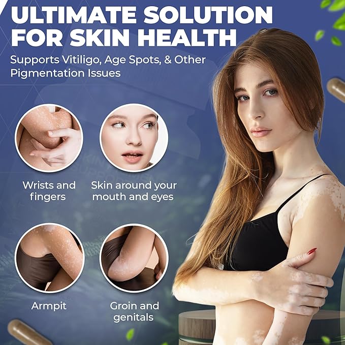 Skin Pigment Support | Polypodium Leucotomos Supplement | Antioxidant & Immune Support | Works Faster Than Vitiligo Cream | Skin Health & Pigmentation Support for Women & Men | 60 Caps