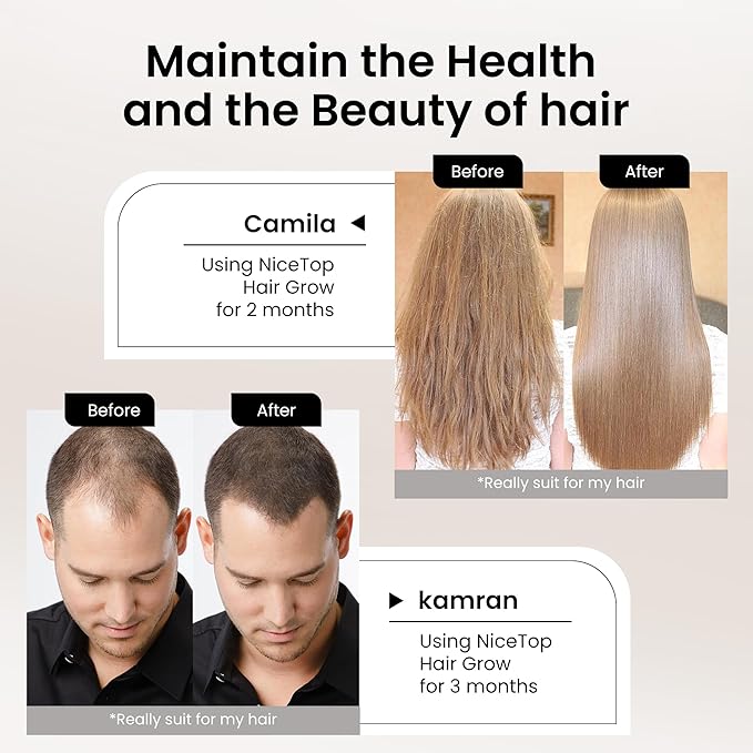 Hair Growth Supplement, Hair Care Support for Strength, Thickness Growth, with Biotin, Vitamin A, C, E, Zinc, 60 Capsules