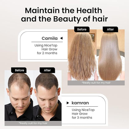 Hair Growth Supplement, Hair Care Support for Strength, Thickness Growth, with Biotin, Vitamin A, C, E, Zinc, 60 Capsules